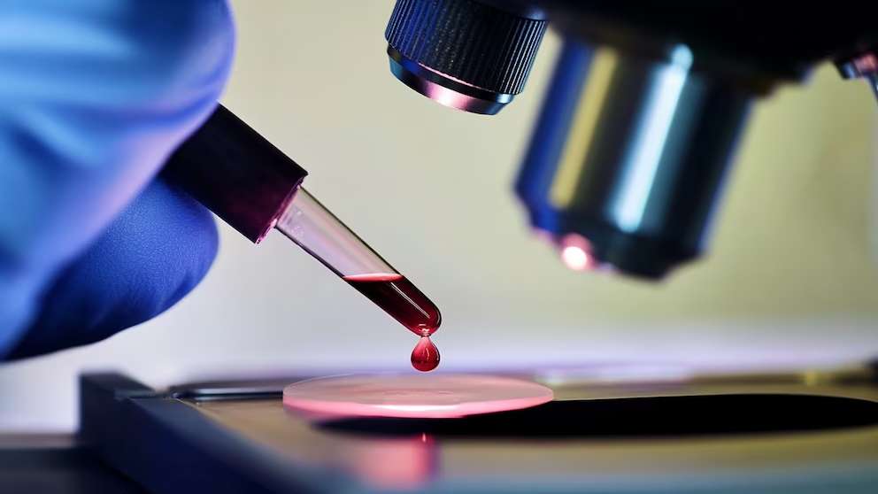 El cáncer tiene un nuevo rostro: crecen los casos en adultos jóvenes y mujeres