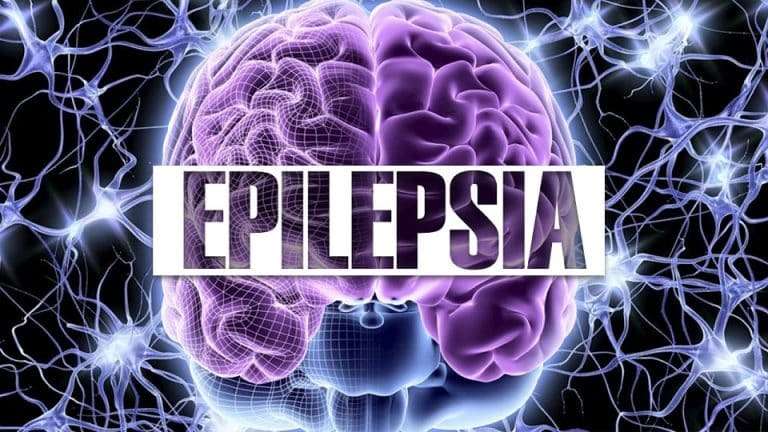 Están abiertas las inscripciones para charla “Epilepsia: entender para actuar”