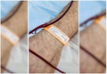 Un simple acto puede salvar vidas: convocan a nuevos donantes de médula ósea